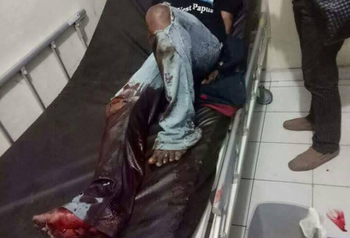 Massacre of 5 people in 24 hours – Under Indonesia, West Papua is becoming another East Timor Massacre of 5 people in 24 hours – Under Indonesia, West Papua is becoming another East Timor